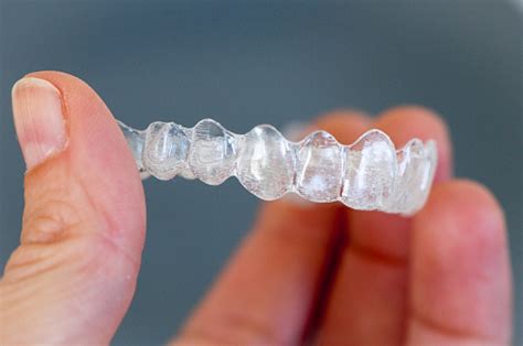 How to invisalign cleaning crystals. Invisalign Aligner Cleaning Dos and Donts - Call Today 855 ...
