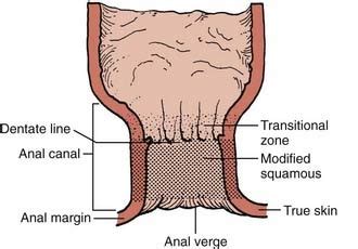 Cancer Of The Anal Canal Clinical Gate