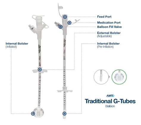 Easy Feed Gastrostomy Tubes By Ross Products Division
