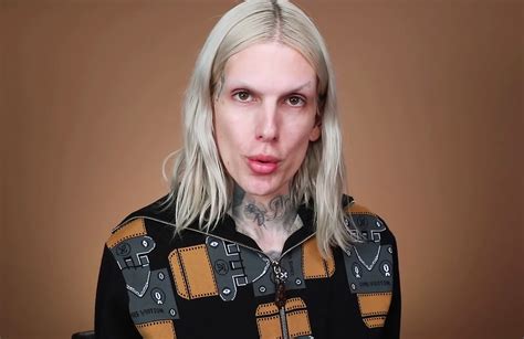 Beauty bay are an approved retailer of jeffree star cosmetics. Jeffree Star Reveals a Doctor Secretly Injected His Lips ...