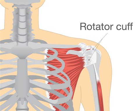 Rotator Cuff Injury Types