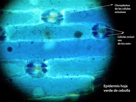 Ciencias Naturales 1 Oja ObservaciÓn De CÉlulas Vegetales