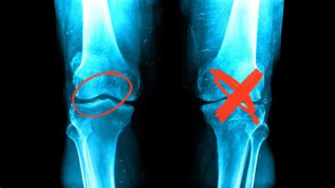 potential causes of stiff joints and what to do about them new mexico orthopaedic associates