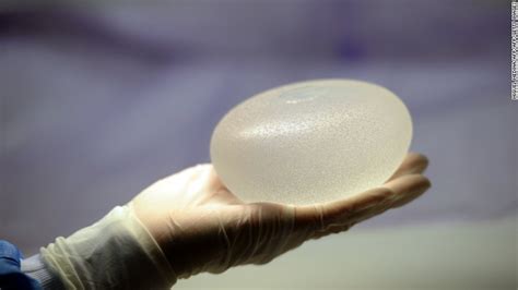 Breast Implants Recalled On Mass In Us By Irish Based Company Due To