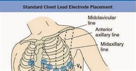 Medical Laboratory And Biomedical Science Ecg Chest Leads