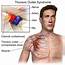 Anatomy Of The Thoracic Outlet And Syndrome
