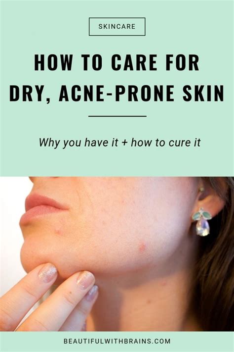 How To Deal With Acne And Dry Skin Beautiful With Brains