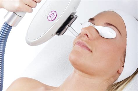 Treatment For Age Spots And Sun Damage · The Lynton Clinic Cheshire