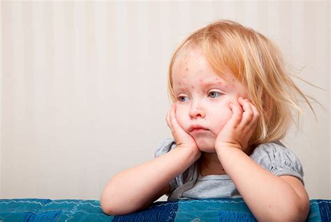 Температура и сыпь у ребенка причины появления мелкой сыпи после
