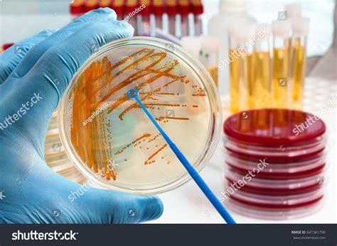 Bacterial Culture Over 6900 Royalty Free Licensable Stock Photos