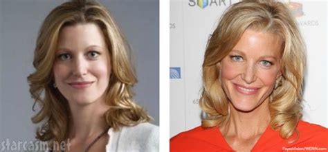 Anna Gunn Before And After Weight Loss Plus Why She Gained Weight