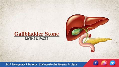 Dr Shwetank Prakash What Causes Gallstones Signs And Symptoms Of