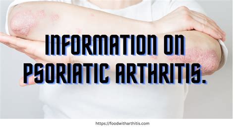 Information About Psoriatic Arthritis Youtube