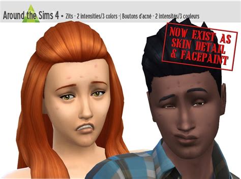 Sims 4 Acne Cc