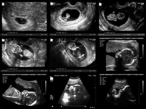 How A Fetus Grows During The First Months Of Pregnancy Pregnancy