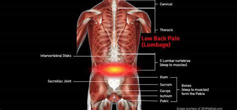 Management Of Low Back Pain Beacon Pharmaceuticals Limited