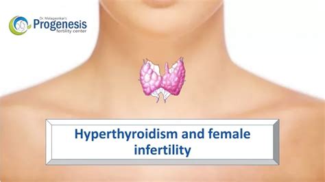 Ppt Hyperthyroidism And Female Infertility Powerpoint Presentation