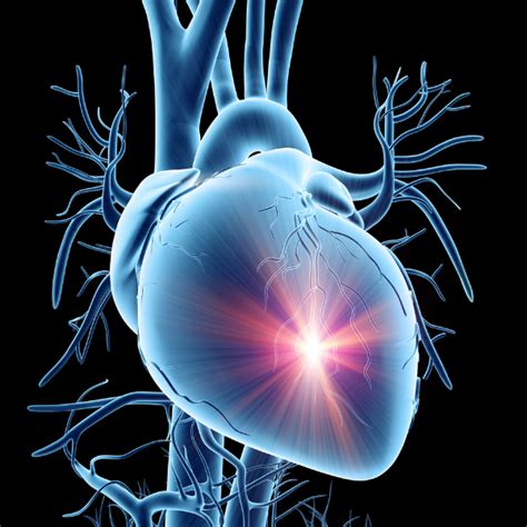 Cardiac Effects On The Spectral Doppler Waveform In Vascular Testing