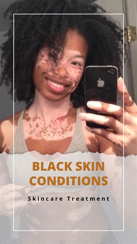 Black Skin Conditions Udodi Skincare