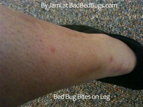 Bed Bug Complaint Registry pg2