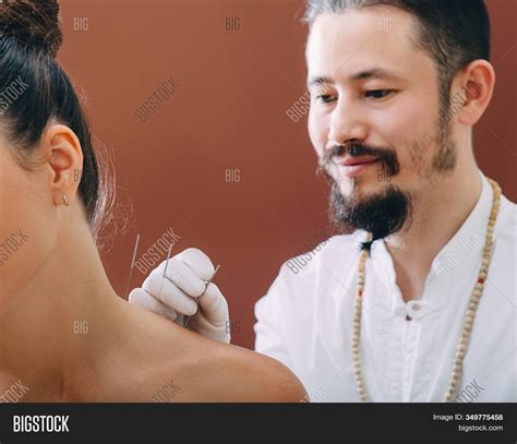 Asian Acupuncturist Image And Photo Free Trial Bigstock