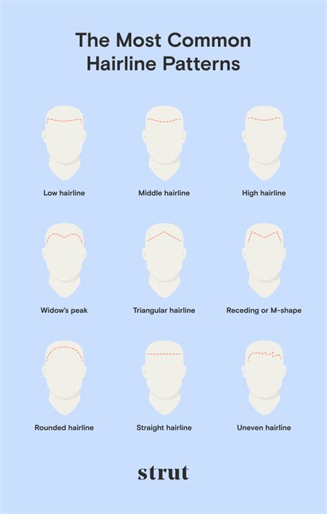 10 Common Types Of Hairlines In Men And Women Strut Blog