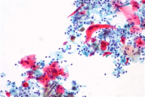 Evolution Of Pap Stain Biomedical Research And Therapy