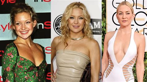 Kate Hudson Plastic Surgery Before And After Pictures