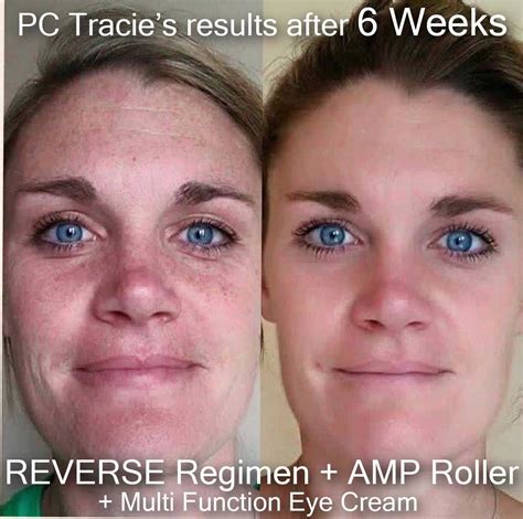 Amazing Results After Only 6 Weeks On Rodan And Fields REVERSE Regimen