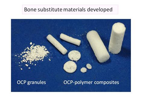 Research Profile 178 Development Of Novel Bone Substitute Biomaterials