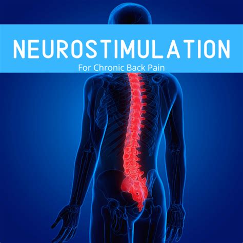 Neurostimulation For Chronic Back Pain New Jersey Comprehensive