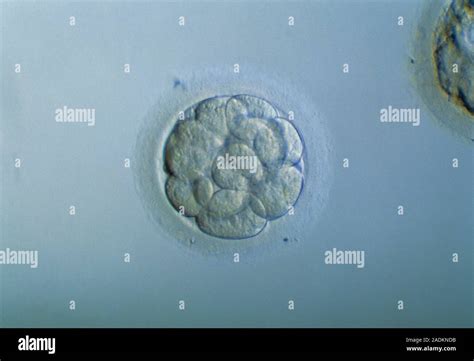 Morula Embryo Light Micrograph Of A Human Embryo At The Morula Stage