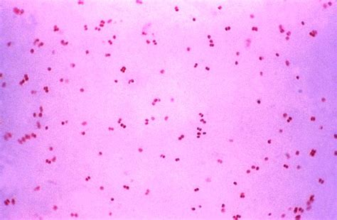 Neisseria gonorrhoeae and neisseria meningitidis are both gram negative bacteria. Neisseria gonorrhoeae - Wikipedia
