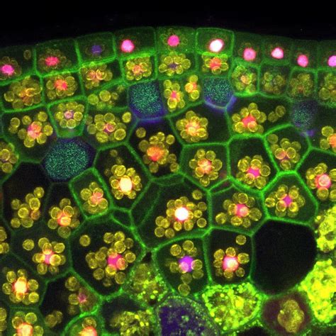 Plant Cells Under The Microscope Pics