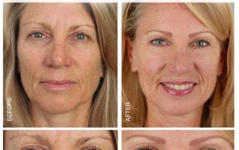 Semi Permanent Eyebrows By Microart Semi Permanent Makeup Permanent