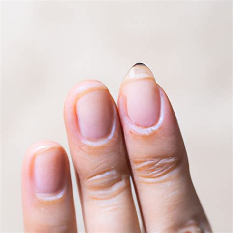What Do Your Fingernails Say About Your Health A Comprehensive Guide