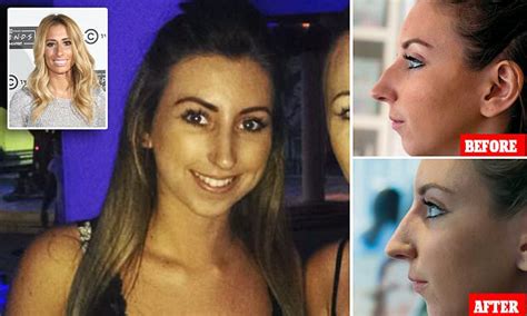 Woman Gets Nose Job After Being Bullied For Looking Like X Factor Stacey Solomon Daily Mail Online