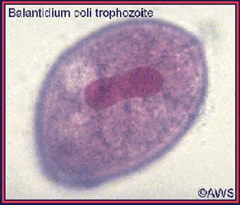 Parasitology Phylum Protozoa Flashcards Quizlet