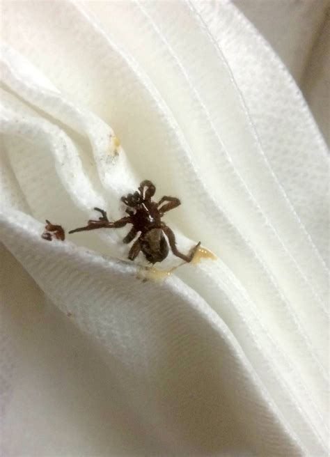 Woman Has Live Spider Pulled From Ear In Video Sure To Be Your Worst