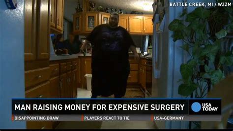 Man With 100lb Scrotum Was Told To Lose Weight