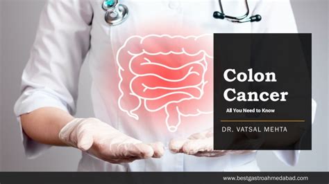 Ppt Colon Cancer In Young Adults What You Need To Know Powerpoint