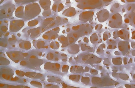 Close Up Of Normal Human Spongy Bone Stock Image P1050067
