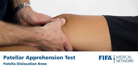Patellar Apprehension Test Patella Dislocation Knee Youtube