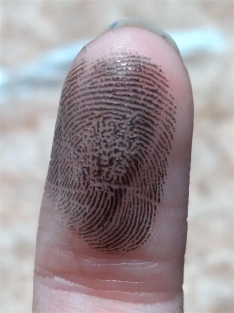 My Fingerprint Is A Little Messed Up From When I Burned It As A Baby