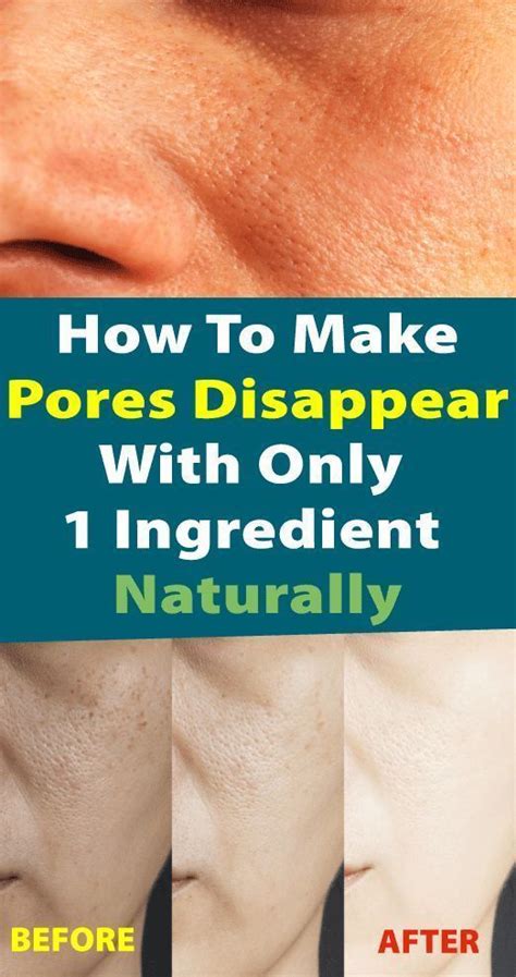 How To Make Pores Disappear With Only 1 Ingredient Naturally Hair