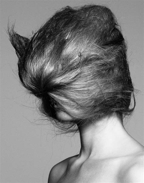 A Hairy Situation Courtesy Of Gregory Harris W Magazine Hair Loss