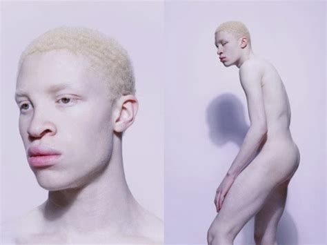 Albino Men Nude LPSG