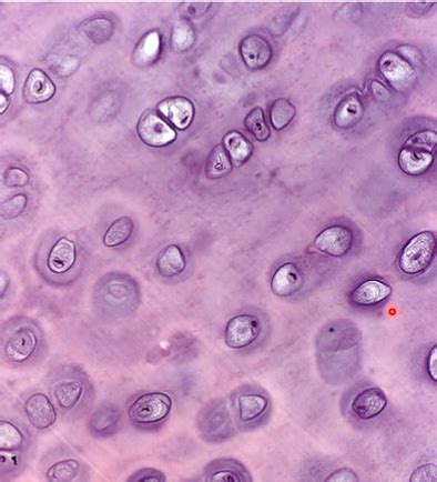 Hyaline Cartilage Diagram Quizlet