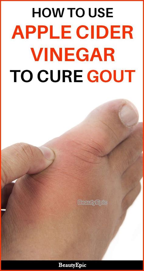 How To Use Apple Cider Vinegar To Cure Gout Bakingsodahair