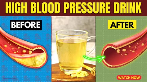 Drinks That Normalize High Blood Pressure And Clean Arteries Youtube